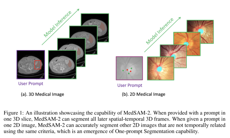 Oxford researchers unveil MedSAM-2, an AI that could change how doctors analyze medical images