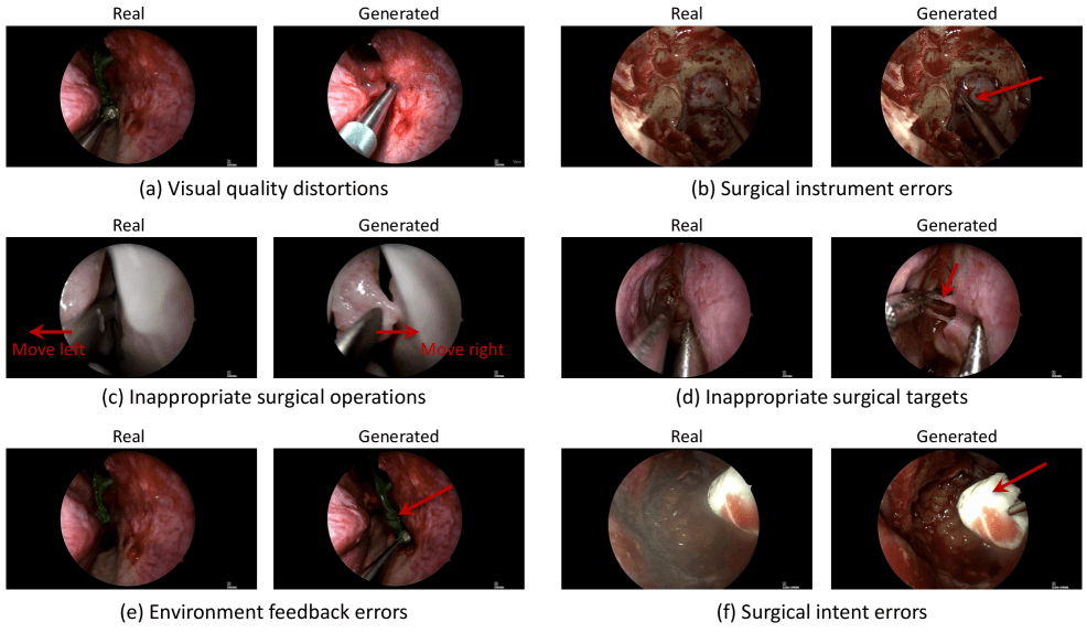 Six comparison frames: real vs. generated with errors in image quality, instrument guidance, operation, target selection, tissue response, and intention